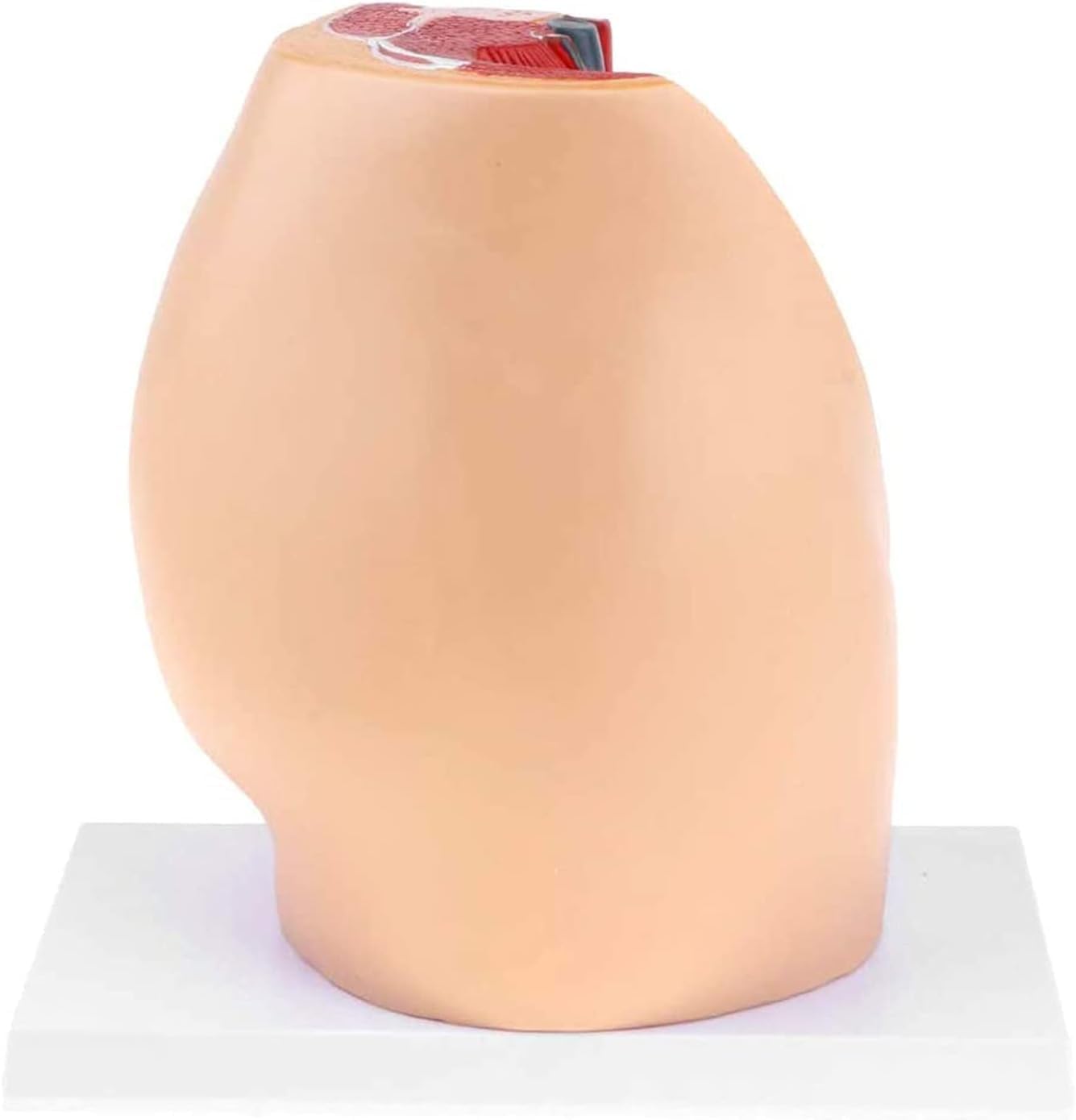 Model Anatomiczny Miednicy żeńskiej, Przekrój Strzałkowy Pośrodkowy, Ginekologiczne Zapalenie Gruczołu Krokowego Z Więzadłami, Naczyniami, Nerwami, Dnem Miednicy I Narządami, Do Szkoleń Med