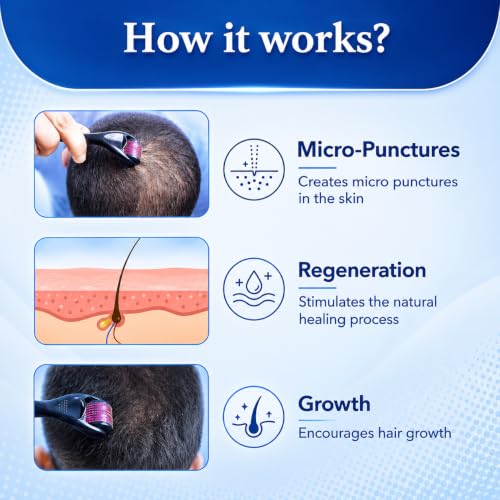 Image of Advanced Derma Roller for Hair Growth 0.5 mm - 540 Titanium Needles for Scalp & Beard Care | Thicker Looking Hair | Easy Grip Handle | Reusable Easy to use