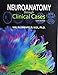 Neuroanatomy through Clinical Cases