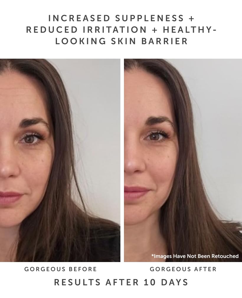Earth Harbor | HORIZON Ceramide Recovery Serum - Skin Barrier + Hydration | Phytosterols + Blue Lotus + Beta Glucan | 20 ml