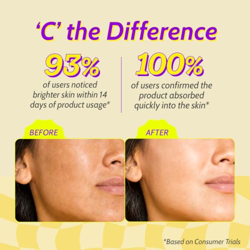 Image of Chemist At Play 10% Vitamin C Serum for Glowing Skin | Pigmentation & Dark Spots | Skin Brightening Face Serum | With Ethyl Ascorbic Acid, Lactic Acid & Glucosamine | For Men & Women | 10 ml