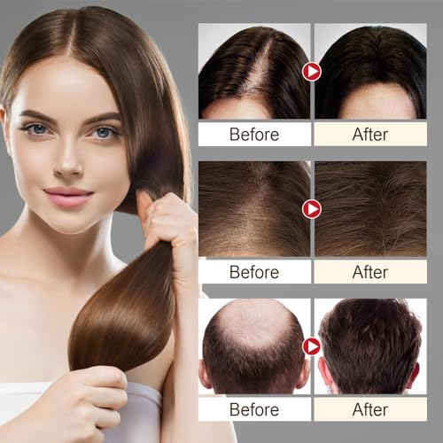 Hair Growth Shampoo,Natural Hair Shampoo With Ginseng and Ginger Root,Moisturizing Soothing,Nourish Scalp,Ganoderma Polygonum Shampoo for Men&Women Use - Image 7