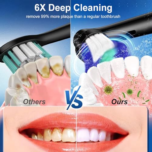 Electric Toothbrush Rotary Rechargeable for Adults Rotating Toothbrush with Soft Brush Heads Deep Clean Electric Toothbrush with 2 Minute Smart Timer IP67 Waterproof (White, 4 Heads) - Image 3