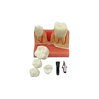Vista 11 de Modelo de 28 dientes Typodont desmontables, modelo de dientes dentales modelo de enseñanza con goma suave para practicar y estudiar, con un