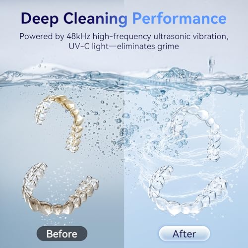 Image of Ultrasonic Retainer Cleaner Machine 48kHz, Dental Ultrasonic Care Cleaner | Ultrasonic Retainer Cleaner for Dentures, Aligners, Mouth Guards, Toothbrush Heads and Jewelry with 200ML Capacity