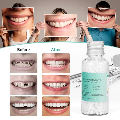 Image of Tooth Repair Kit with 4 Dental Tools, Temporary Tooth Replacement Set, Moldable Dental Fix