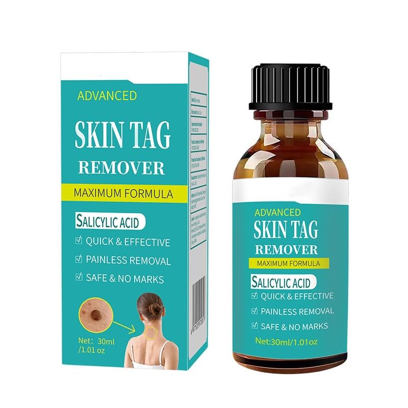 AONARY TAG WART Remover Remover