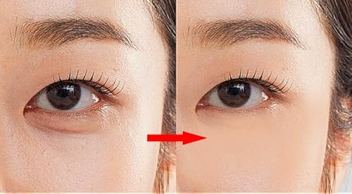 Whitesilk Anti-Aging Eye & Neck Scm(Human Stem Cell) Power Ampoule (10Ml X 2Vials, 0.68Oz) #TOP5