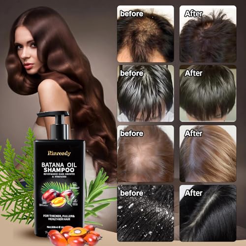 Image of Batana Rosemary Shampoo for Thinning Hair, Biotin Strengthening Shampoo for Men & Women,Nourishing Scalp Care for Fuller Looking,Healthier Hair,Sulfate Free Daily Hair Cleanser 10.15 fl oz
