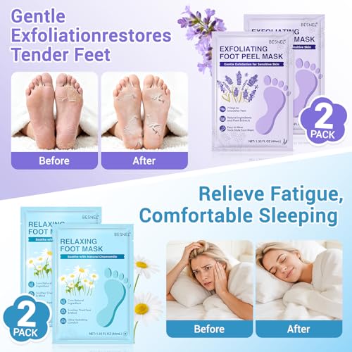 8 Pack Moisturizing Foot Mask,Hydrating Foot Masks for Dry Cracked Feet,Brightening Soothing Dry Skin Moisturizer for Baby Soft Feet,Mothers Day Gifts,Foot Care Spa Gifts for Women Men(4 Styles)