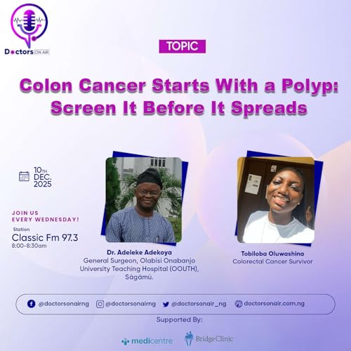 Colon Cancer Starts With a Polyp- Screen It Before It Spreads