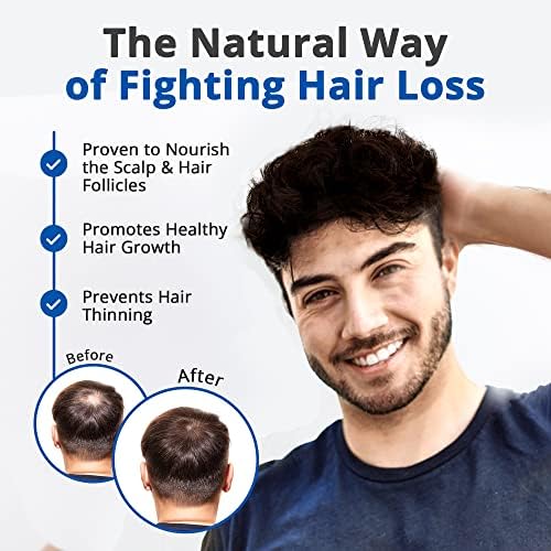 HAIRMETTO Saw Palmetto Stinging Nettle Serum for Hair Growth, Hair