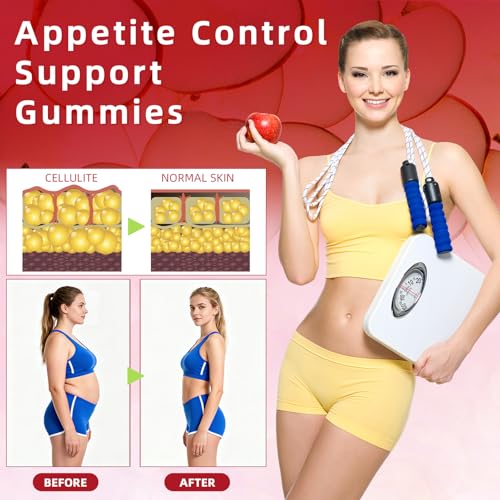 Apple Cider Vinegar Gummies 1500mg with “The Mother” – ACV Gummies with Vitamin B6, B12 & Folic Acid – Supports Digestion, Energy– Natural Apple Flavour – 90 Vegan Count - Image 8