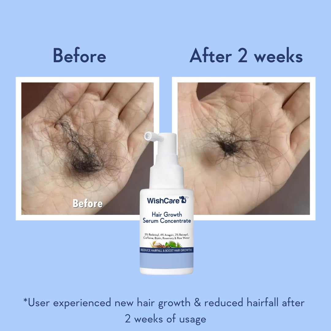 WishCare Hair Growth Serum Concentrate - Rosemary, 3% Redensyl, 4% Anagain, 2% Baicapil, Caffeine, Biotin, Plant Keratin & Rice Water - Image 4