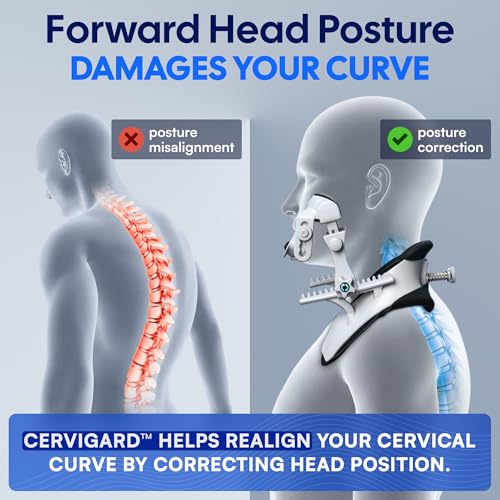 Forward Head Posture Corrector Neck Collar – Cervical Traction Brace for Text Neck, Neck Pain Relief, Spine Alignment, Cervical Lordosis Support, Posture Correction Device (Small/Medium) Detail