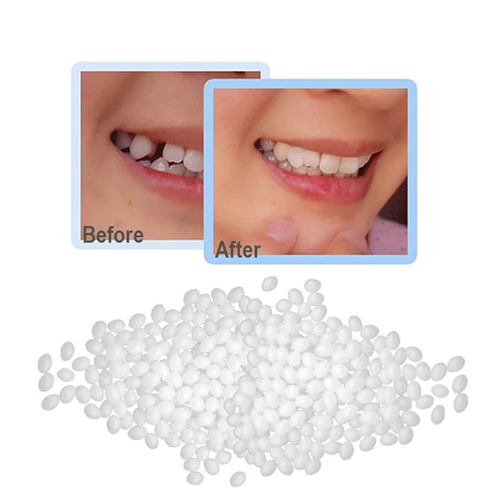 Buy Temporary Teeth Repair Filling Thermal Fitting Beads for Fix