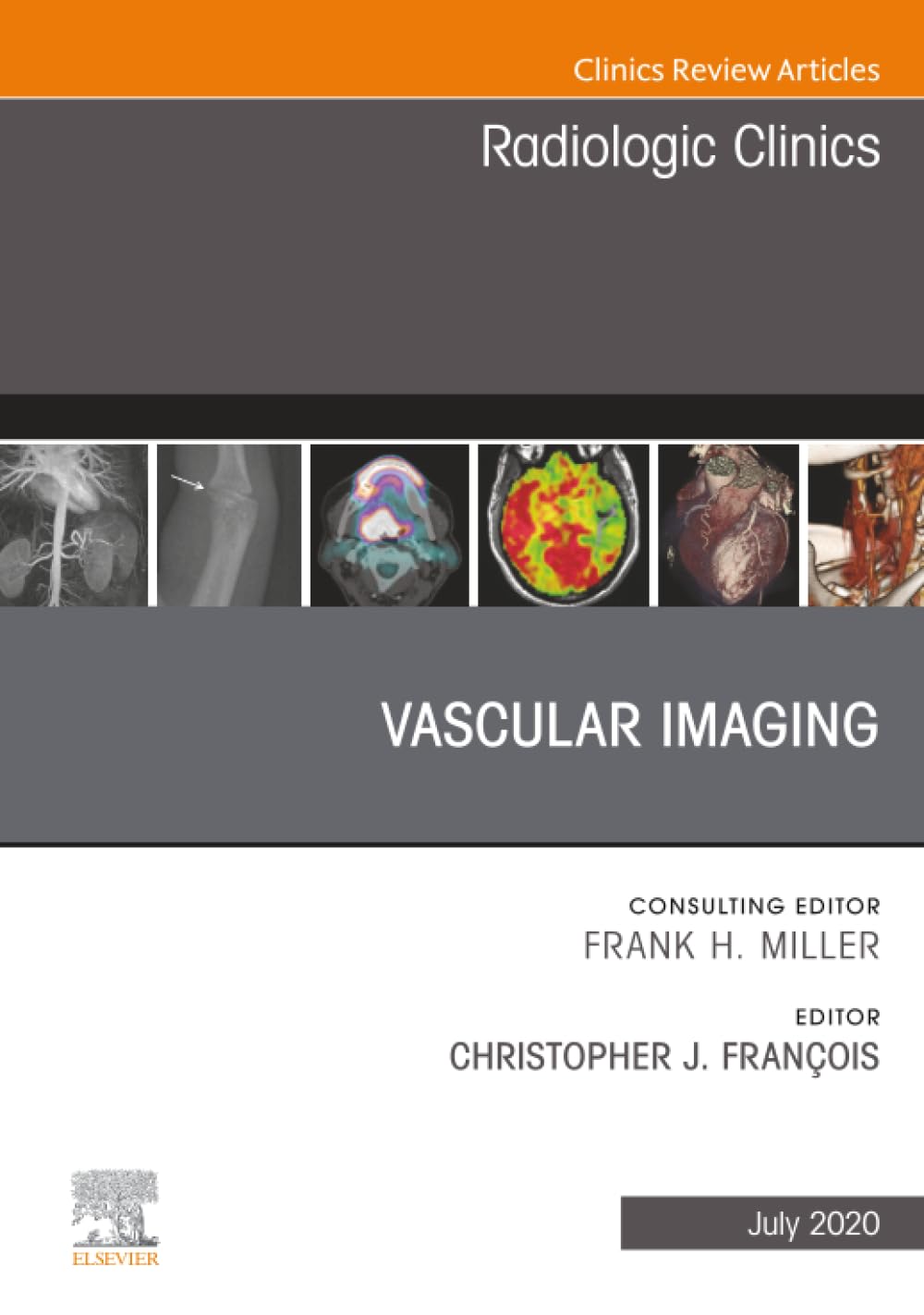 Vascular Imaging, An Issue of Radiologic Clinics of North America: Volume 58-4 (The Clinics: Radiology, Volume 58-4)
