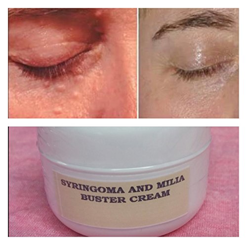 cce herbal products syringoma and milia buster cream