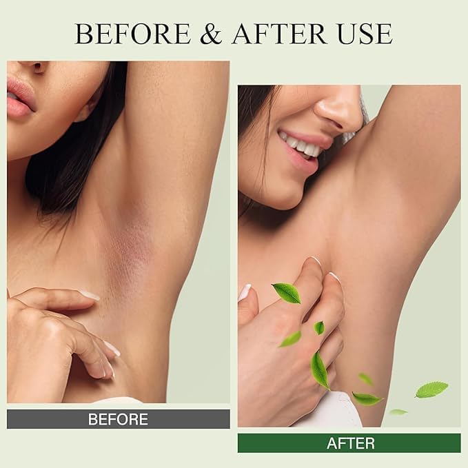 Image of Underarm Brightening Spray 5% Glycolic Acid | Face, Neck, Knees & Body Exfoliating Toner | Fades Dark Spots, Hyperpigmentation & Evens Skin Tone | Multi-Purpose Brightening Spray (100ml) (Pack of 1)