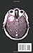 The Bomb Inside My Brain