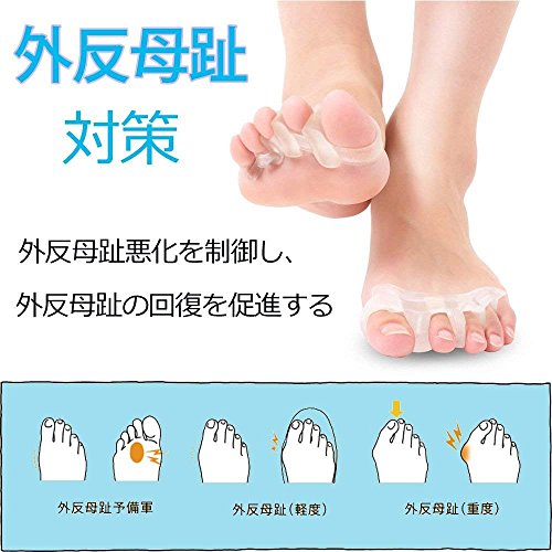 最安値 足 指 広げる パッド 浮き指 内反小趾 矯正 健康グッズ Sukwii フットケア 足 指 セパレーター 足のゆび ひろげる シリコン製 男女兼用 5本指 2足組セットの価格比較