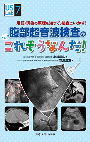 無料電子書籍 pdf 腹部超音波検査の へぇ~!! これそうなんだ! : 用語・現象の原理を知って、 バイ