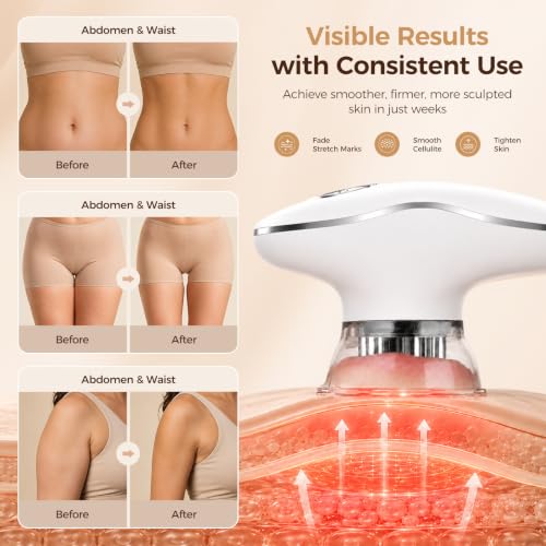 HuixinLine 4 in 1 Body Sculpting Machine, Anti Cellulite Massage Tool,Lymphatic Drainage Massager,Reduce Stretch Marks & Cellulite & Tightens Skin,for Back, Belly, Arms, Legs.(White) - image 6