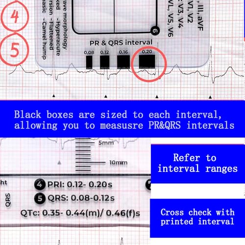 Reglas de ECG de 7 pasos para el bolsillo de la bata en pases de guardia 6