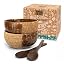 2 Bowl Set | Striped