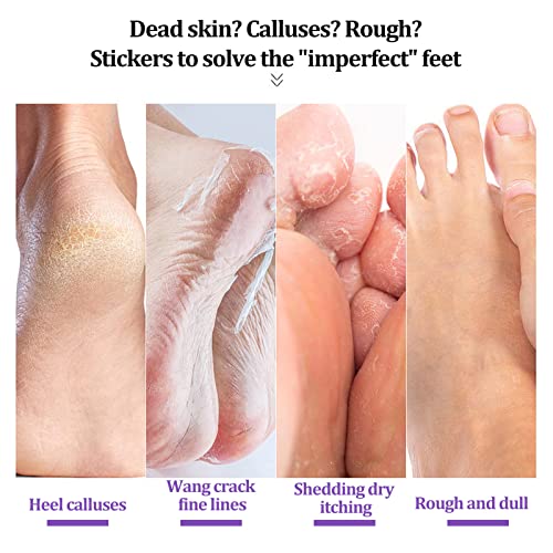 Qudai 1 par/saco Gengibre Máscara para os Pés Esfoliante Esfoliante Nutrir Reparação Delicado Cuidad