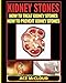 Kidney Stones: How To Treat Kidney Stones: How To Prevent Kidney Stones (Kidney Stone Treatment & Prevention Guide with All)