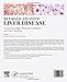 Metabolic Steatotic Liver Disease: Current Knowledge, Therapeutic Treatments, and Future Directions