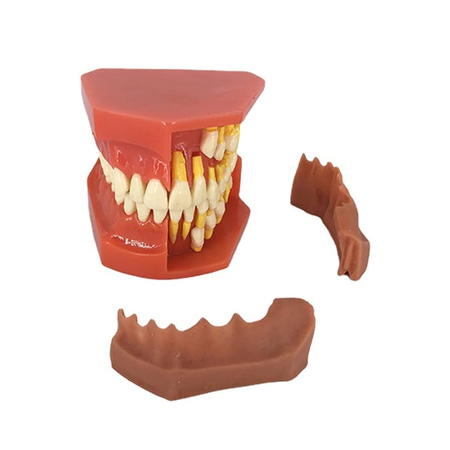 Amazon.co.jp: 口腔模型歯科模型、歯科標準指導歯モデル取り外し