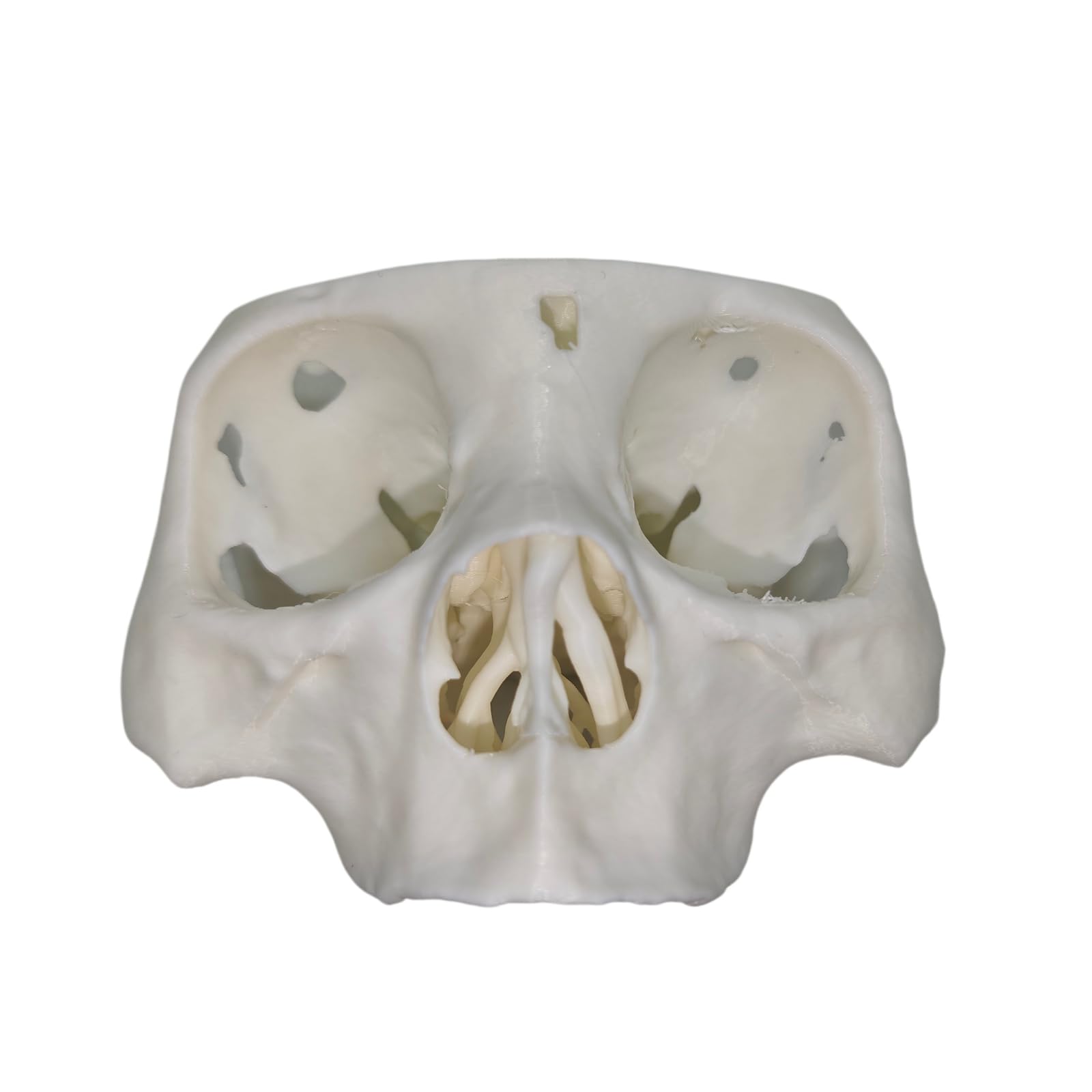 YRQMGSF Dental Zygomatic Implant Model Realistic Human Anatomy Practice Model for Zygomatic And Pterygoid Implants