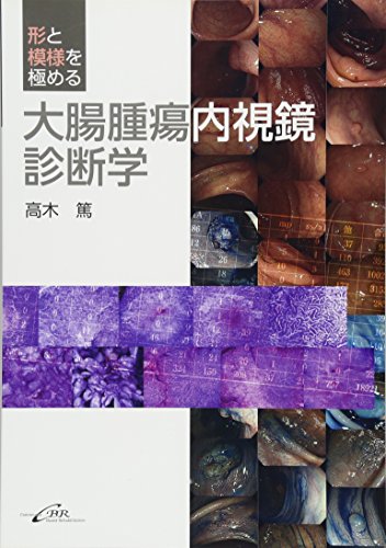 キンドル 無料電子書籍 形と模様を極める大腸腫瘍内視鏡診断学 バイ