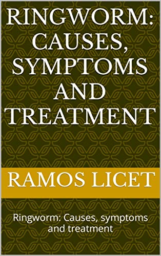 Ringworm: Causes, symptoms and treatment: Ringworm: Causes, symptoms and treatment