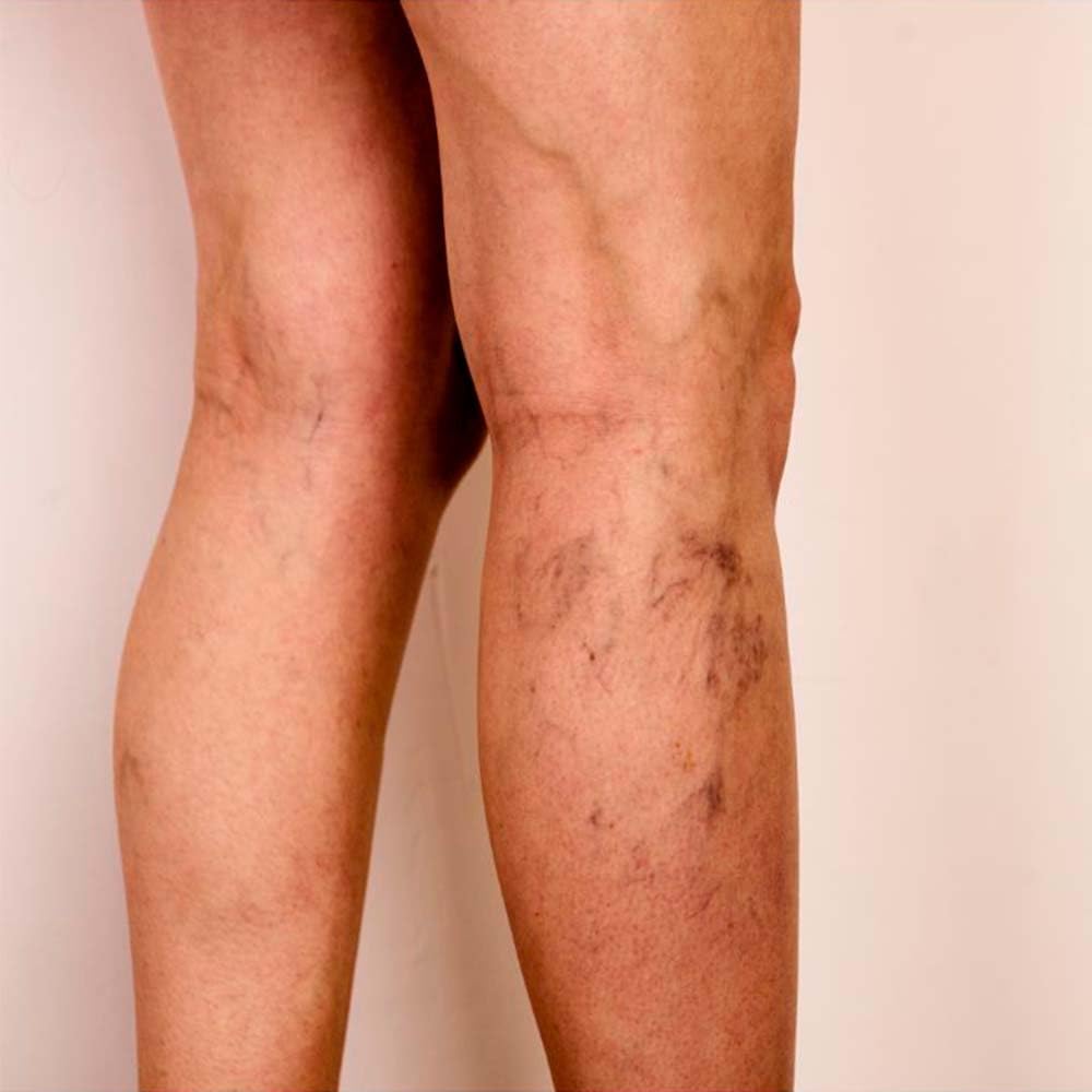 Pack 10 Jabón natural exfoliante Algas marinas - Exfoliante, drenante, reafirmante y anticelulítico. Para uso corporal