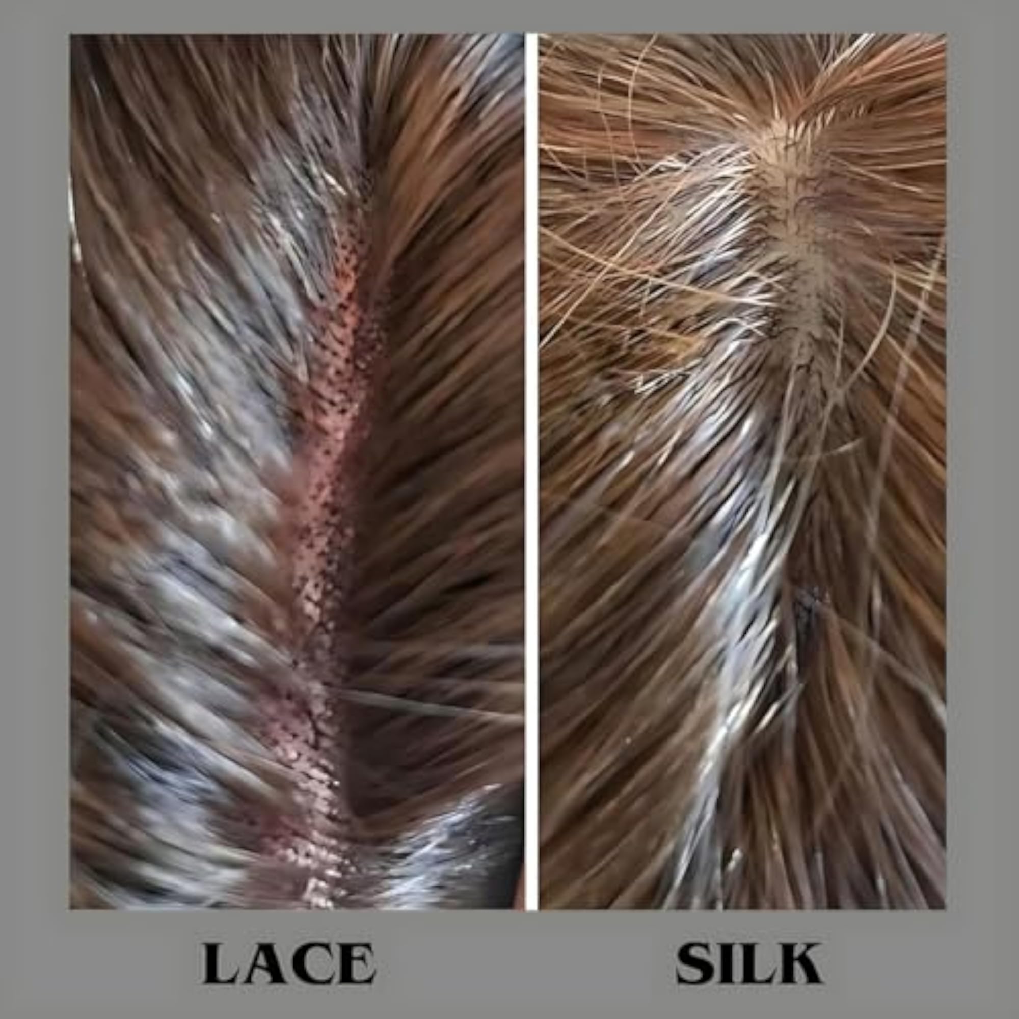 HAIR4ALL Lace Hair Toppers, Black Brown