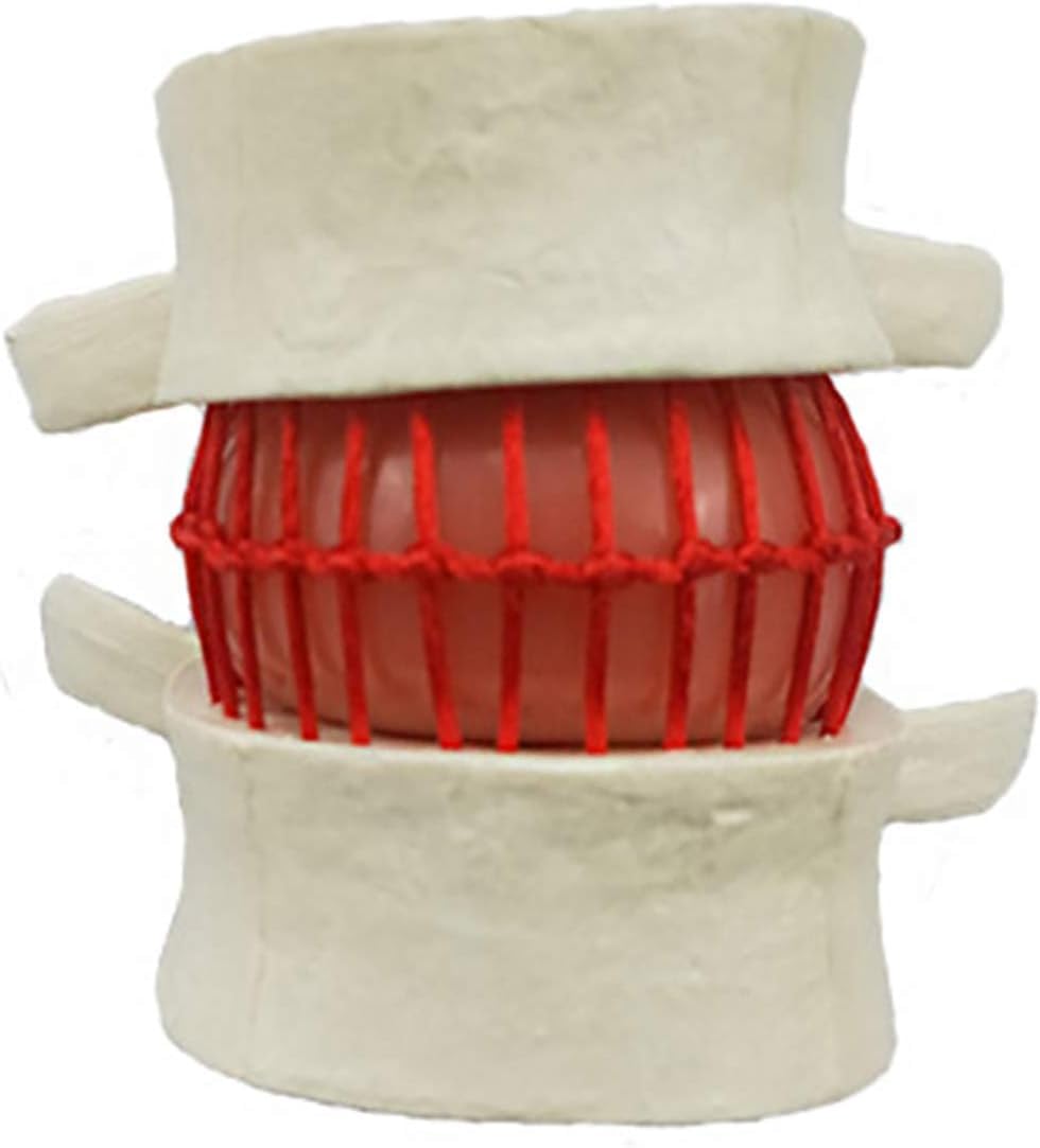 Modello di Dimostrazione del Disco Lombare Umano Modello della Colonna Sonora del Dorso Giallo Umano Colonna Lombare Anatomica Colonna Vertebrale Lombare