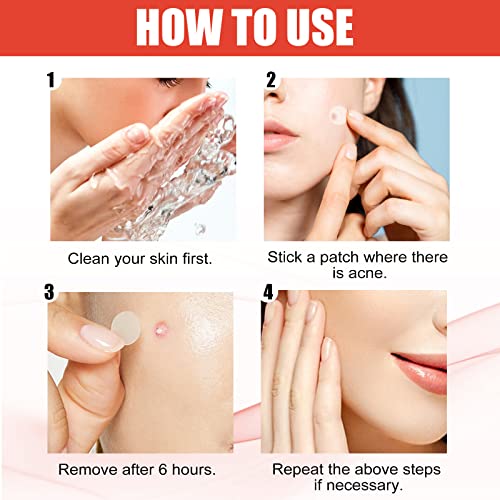 Acne Patch Pimple Patch(144 Pack), Daytime Acne Pimple Patches For Covering Zits And Blemishes, 2 Sizes 144 Patches Acne Absorbing Cover Patch, Invisible Acne Patches For Face Zit Patch Acne Dots #TOP6