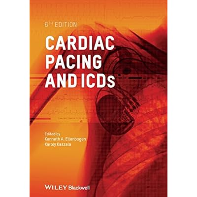 Cardiac Pacing and ICDs