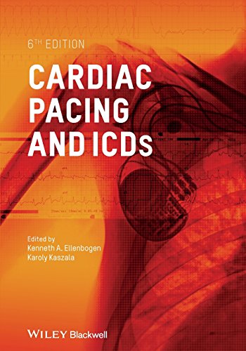 Cardiac Pacing and ICDs