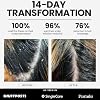 Anti-Dandruff Shampoo with 2% Pyrithione Zinc & Stem Cells, Extra Strength for Flaky, Itchy, Oily & Dry Scalp Treatment, Fragrance Free, Color Safe, Sulfate Free
