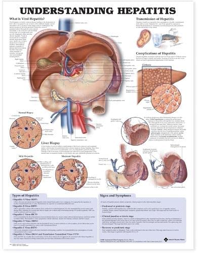 Understanding Hepatitis Anatomical Chart #TOP8