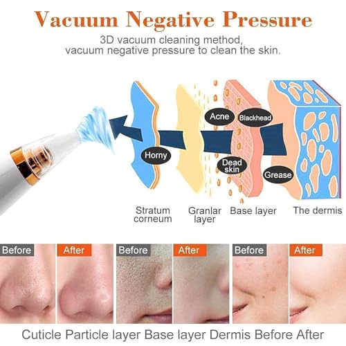 Image of Multi-function Blackhead Remover Tools | Electric Derma suction Machine | USB Rechargeable Acne Pimple Pore Cleaner Vacuum tool | Facial Cleanser Device for Nose & Skin Care (6in 1 Red)
