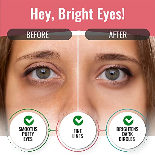 Eye Mask For Puffiness - Under Eye Patches For Dark Circles - Korean Under Eye Mask Patches For Puffy Eyes - Eye Gel Pads Depuffing Eye Brightener With Aloe Vera, Green Tea, Rose, Caffeine, Hydrogel & Collagen (20 Pairs) #TOP1