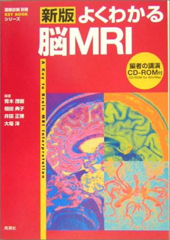 無料電子書籍 pdf 新版 よくわかる脳MRI (『画像診断』別冊KEY BOOKシリーズ) バイ