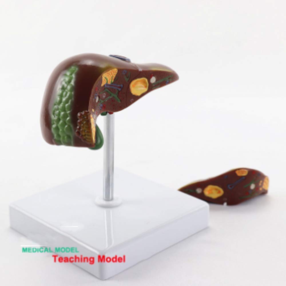 Model Edukacyjny Model Anatomiczny Patologia Wątroby Człowieka Kamień Anatomiczny Model Dla Badań Pedagogicznych Medycznych Materiały Dydaktyczne Laboratorium Demonstracyjne