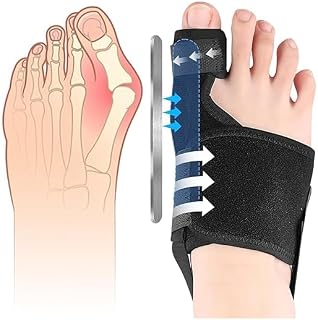 Corrector De Juanete, Nocturno Y Día, Con Férula De Aluminio Flexible Integrada, Tamaño Ajustable, Reutilizable Y Antideslizante, Apto Para Mujeres Y Hombres (Pierna Derecha)