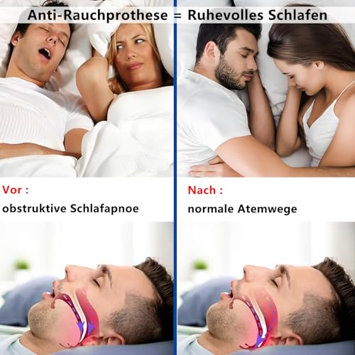 DOHUG Schnarchschiene Verstellbare Aufbissschiene gegen Schnarchen und Knirschen - Anti Schnarch Schnarchstopper - Anti-Snoring Mouth Guard - Verbessert Schlafqualität (Mattblau mittel)